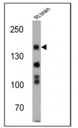 SP5116P - NOS1