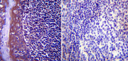 SP5395A - Heat shock protein 104 / HSP104