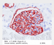 T-2038 - Podoplanin