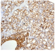 TA307534 - CD166