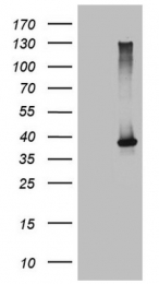 TA809536 - CD336