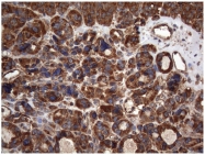 TA809536 - CD336