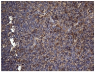 TA809536 - CD336
