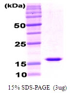 SA6051 - Adiponectin