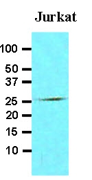 AM09009PU-N - FADD