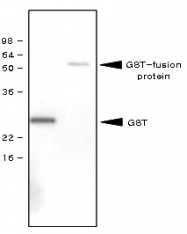 SM6024 - GST-Tag