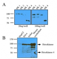 AM05641PU-N - Hexokinase