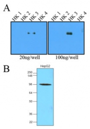 AM09014PU-N - Hexokinase-3