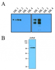 AM03129PU-S - Hexokinase-1/2
