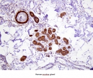 AM09017PU-N - Heat shock protein 70 / HSP70