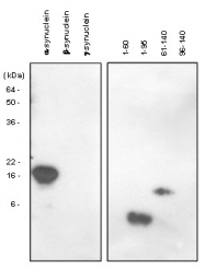 SM6028 - Alpha-Synuclein / SNCA