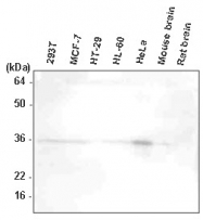 SM6012 - HTRA2 / PRSS25