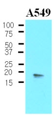 AM03185PU-N - PPP1R14A
