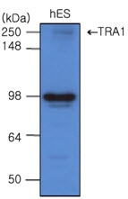 AM09037PU-N - Endoplasmin / HSP90B1 / TRA1