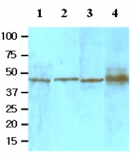 AM09047PU-N - TGFBI / BIGH3