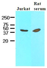 AM09058PU-N - Interleukin-12 beta / IL12B