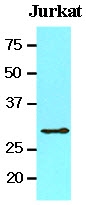 AM09060PU-N - 14-3-3 protein theta
