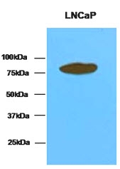 AM09069PU-N - Transglutaminase-4 (TGM4)
