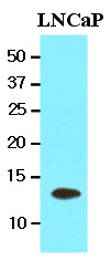 AM09084PU-N - TBCA