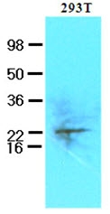 AM09138PU-N - UBE2S