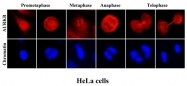 AM09372PU-N - Aurora kinase B