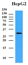 AM09374PU-N - NMNAT1