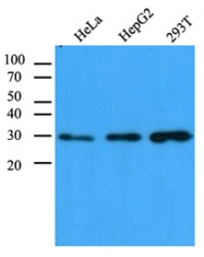 AM09388PU-N - Carbonyl reductase 1