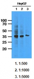 AM09389PU-N - AKR1C1 / DHH1