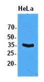 AM09396PU-N - EIF2A / EIF2S1