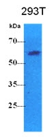 AM09397PU-N - PKLR