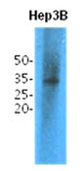 AM09399PU-N - Thiopurine methyltransferase (TPMT)
