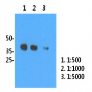 AM39075PU-N - Influenza A H1N1