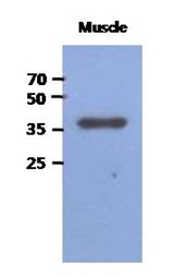 AM50022PU-N - FBP2