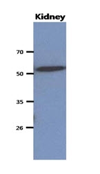 AM50023PU-N - CNDP2