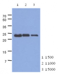 AM50025PU-N - Skeletal muscle Troponin I