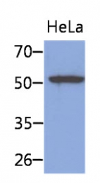 AM50038PU-N - Cytokeratin 8
