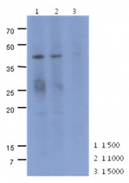 AM50042PU-N - Mevalonate kinase
