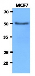 AM50044PU-N - Beta-hexosaminidase alpha / HEXA