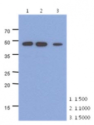 AM50058PU-N - Neuron specific enolase