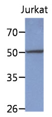 AM50063PU-N - Protein phosphatase 1F / PPM1F