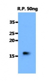 AM50082PU-N - Tumor necrosis factor (TNF-alpha)