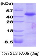 AR09155PU-L - Dysbindin