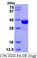 AR09162PU-L - SULT1E1