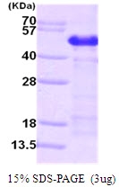 AR09196PU-L - Calumenin