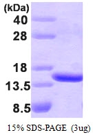 AR09214PU-L - TBCA