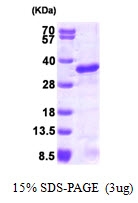 AR09255PU-L - UBE2S