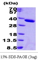 AR09273PU-L - Esterase D (ESD)