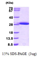 AR09296PU-L - GSTM1