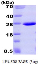 AR09378PU-L - Aprataxin