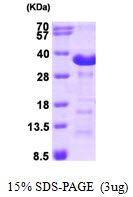 AR09383PU-L - ASPH